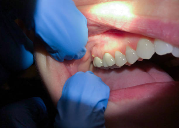 Best Cosmetic Emergency Dentistry in Melrose Park, IL