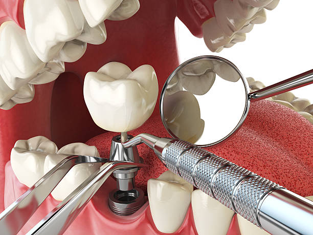 Best Emergency TMJ Treatment in Melrose Park, IL